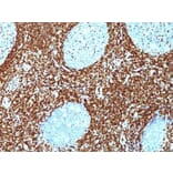 Immunohistochemistry (formalin-fixed, paraffin-embedded) - Anti-Bcl-2 Antibody [BCL2/782 + BCL2/796] (CF®488A) (A353048) - Antibodies.com