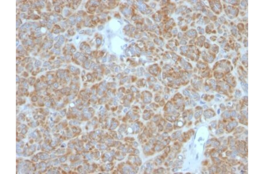 Immunohistochemistry (formalin-fixed, paraffin-embedded) - Anti-Bcl-2 Antibody [BCL2/782 + BCL2/796] (CF®594) (A353049) - Antibodies.com