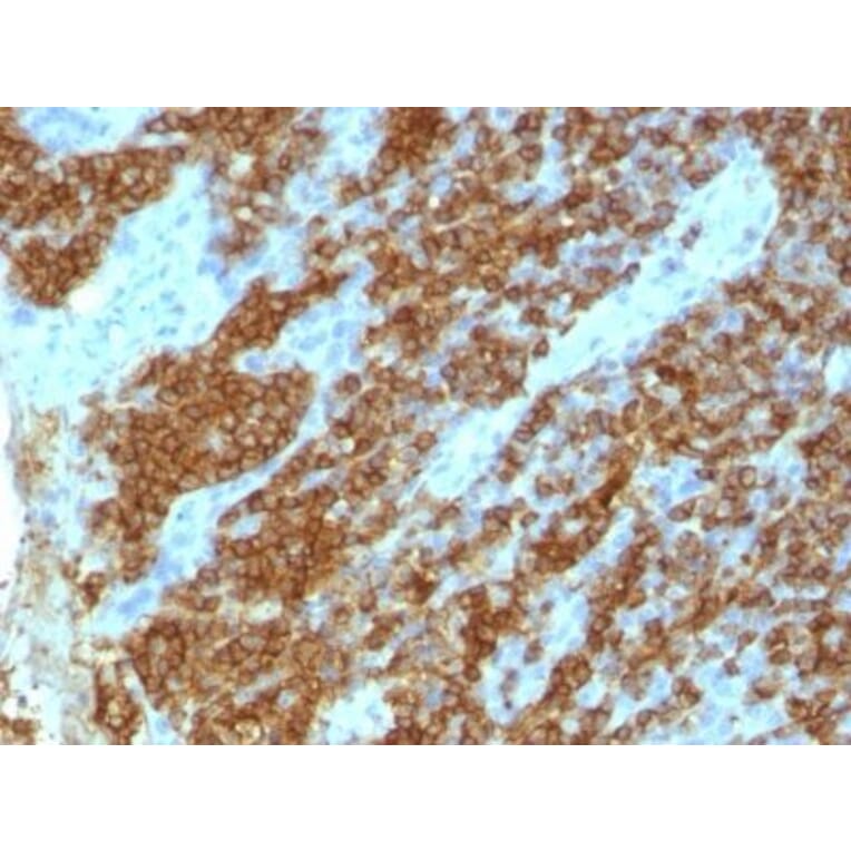 Immunohistochemistry (formalin-fixed, paraffin-embedded) - Anti-CD45RA Antibody [111-1C5] (CF®405S) (A353070) - Antibodies.com