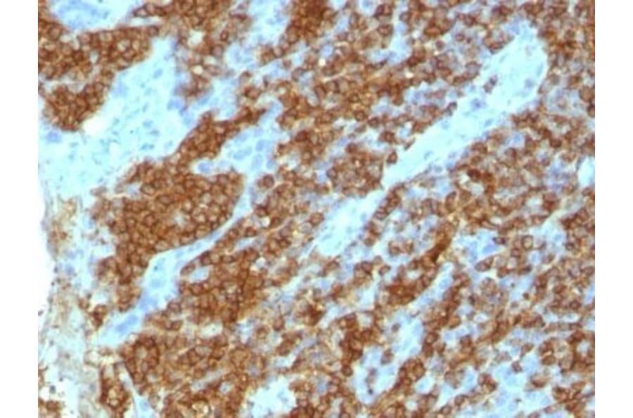 Immunohistochemistry (formalin-fixed, paraffin-embedded) - Anti-CD45RA Antibody [111-1C5] (CF®740) (A353074) - Antibodies.com
