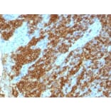 Immunohistochemistry (formalin-fixed, paraffin-embedded) - Anti-CD45RA Antibody [111-1C5] (CF®740) (A353074) - Antibodies.com