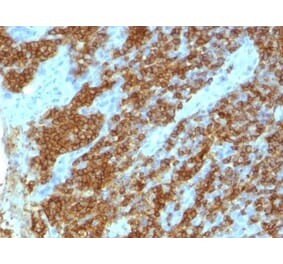 Immunohistochemistry (formalin-fixed, paraffin-embedded) - Anti-CD45RA Antibody [111-1C5] (CF®488A) (A353075) - Antibodies.com