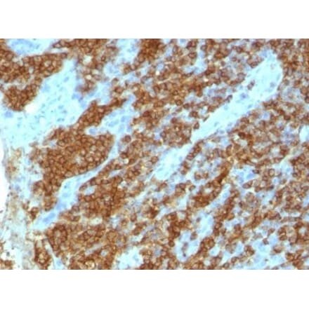 Immunohistochemistry (formalin-fixed, paraffin-embedded) - Anti-CD45RA Antibody [111-1C5] (Biotin) (A353077) - Antibodies.com