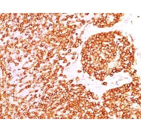 Immunohistochemistry (formalin-fixed, paraffin-embedded) - Anti-CD45RB Antibody [DF-B1] (CF®405S) (A353094) - Antibodies.com