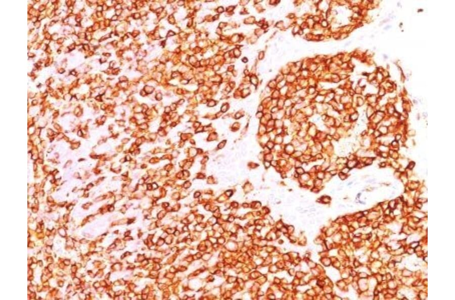 Immunohistochemistry (formalin-fixed, paraffin-embedded) - Anti-CD45RO Antibody [190-2F2.5] (CF®640R) (A353103) - Antibodies.com
