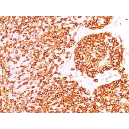 Immunohistochemistry (formalin-fixed, paraffin-embedded) - Anti-CD45RO Antibody [190-2F2.5] (CF®647) (A353104) - Antibodies.com