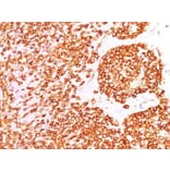 Immunohistochemistry (formalin-fixed, paraffin-embedded) - Anti-CD45RO Antibody [190-2F2.5] (CF®488A) (A353107) - Antibodies.com
