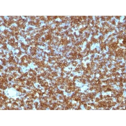 Immunohistochemistry (formalin-fixed, paraffin-embedded) - Anti-CD45RA Antibody [PTPRC/1131] (CF®405S) (A353118) - Antibodies.com