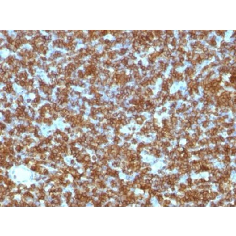 Immunohistochemistry (formalin-fixed, paraffin-embedded) - Anti-CD45RA Antibody [PTPRC/1131] (CF®405S) (A353118) - Antibodies.com
