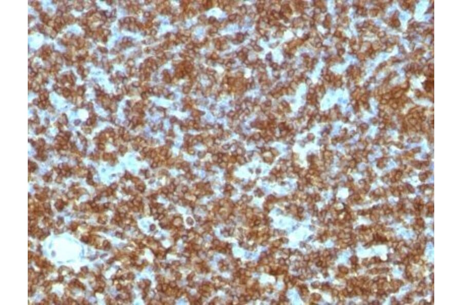 Immunohistochemistry (formalin-fixed, paraffin-embedded) - Anti-CD45RA Antibody [PTPRC/1131] (CF®640R) (A353119) - Antibodies.com