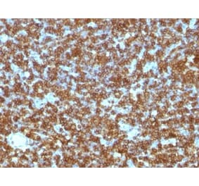 Immunohistochemistry (formalin-fixed, paraffin-embedded) - Anti-CD45RA Antibody [PTPRC/1131] (CF®594) (A353124) - Antibodies.com