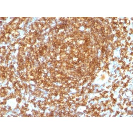 Immunohistochemistry (formalin-fixed, paraffin-embedded) - Anti-CD45RB Antibody [PTPRC/1132] (CF®405S) (A353126) - Antibodies.com