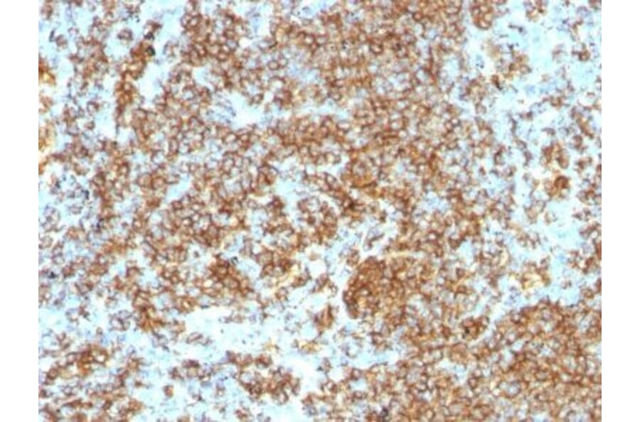 Immunohistochemistry (formalin-fixed, paraffin-embedded) - Anti-CD45RB Antibody [PTPRC/1132] (CF®405S) (A353126) - Antibodies.com