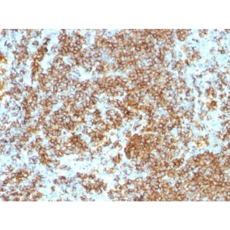 Immunohistochemistry (formalin-fixed, paraffin-embedded) - Anti-CD45RB Antibody [PTPRC/1132] (CF®405S) (A353126) - Antibodies.com