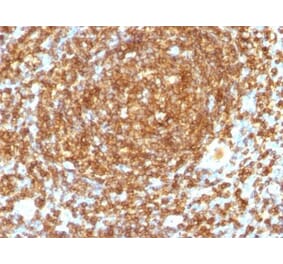 Immunohistochemistry (formalin-fixed, paraffin-embedded) - Anti-CD45RB Antibody [PTPRC/1132] (CF®640R) (A353127) - Antibodies.com