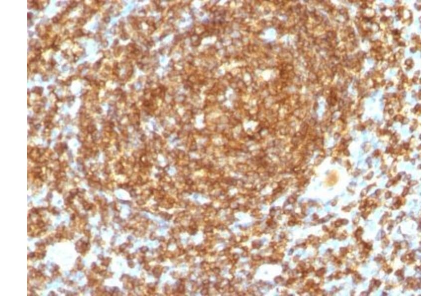 Immunohistochemistry (formalin-fixed, paraffin-embedded) - Anti-CD45RB Antibody [PTPRC/1132] (CF®568) (A353129) - Antibodies.com