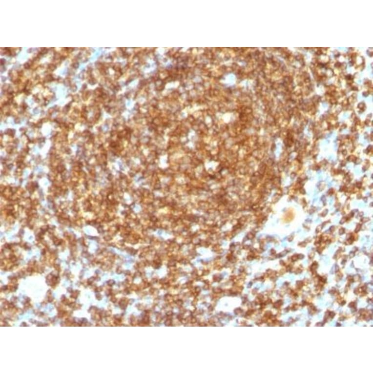 Immunohistochemistry (formalin-fixed, paraffin-embedded) - Anti-CD45RB Antibody [PTPRC/1132] (Biotin) (A353133) - Antibodies.com