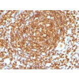 Immunohistochemistry (formalin-fixed, paraffin-embedded) - Anti-CD45RB Antibody [PTPRC/1132] (Biotin) (A353133) - Antibodies.com