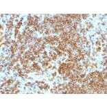 Immunohistochemistry (formalin-fixed, paraffin-embedded) - Anti-CD45RB Antibody [PTPRC/1132] (Biotin) (A353133) - Antibodies.com