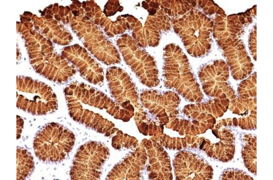 Immunohistochemistry (formalin-fixed, paraffin-embedded) - Anti-MUC5AC Antibody [MUC5AC/917 + 45M1] (CF®640R) (A353135) - Antibodies.com
