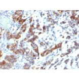 Immunohistochemistry (formalin-fixed, paraffin-embedded) - Anti-MUC5AC Antibody [MUC5AC/917 + 45M1] (CF®647) (A353136) - Antibodies.com