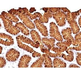 Immunohistochemistry (formalin-fixed, paraffin-embedded) - Anti-MUC5AC Antibody [MUC5AC/917 + 45M1] (CF®568) (A353137) - Antibodies.com