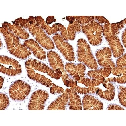 Immunohistochemistry (formalin-fixed, paraffin-embedded) - Anti-MUC5AC Antibody [MUC5AC/917 + 45M1] (CF®488A) (A353139) - Antibodies.com