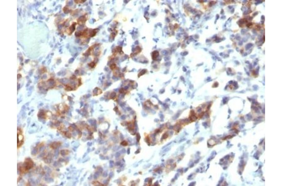 Immunohistochemistry (formalin-fixed, paraffin-embedded) - Anti-MUC5AC Antibody [MUC5AC/917 + 45M1] (CF®488A) (A353139) - Antibodies.com