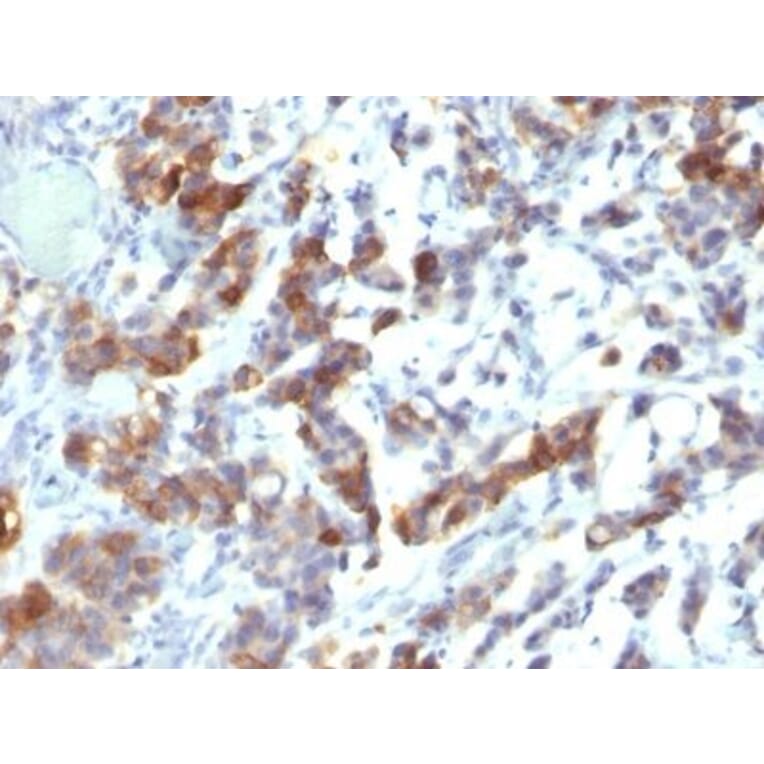 Immunohistochemistry (formalin-fixed, paraffin-embedded) - Anti-MUC5AC Antibody [MUC5AC/917 + 45M1] (Biotin) (A353141) - Antibodies.com