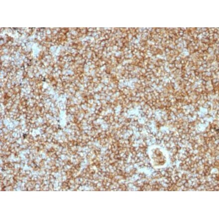Immunohistochemistry (formalin-fixed, paraffin-embedded) - Anti-CD45RB Antibody [PTPRC/1147] (CF®405S) (A353142) - Antibodies.com