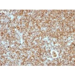 Immunohistochemistry (formalin-fixed, paraffin-embedded) - Anti-CD45RB Antibody [PTPRC/1147] (CF®405S) (A353142) - Antibodies.com