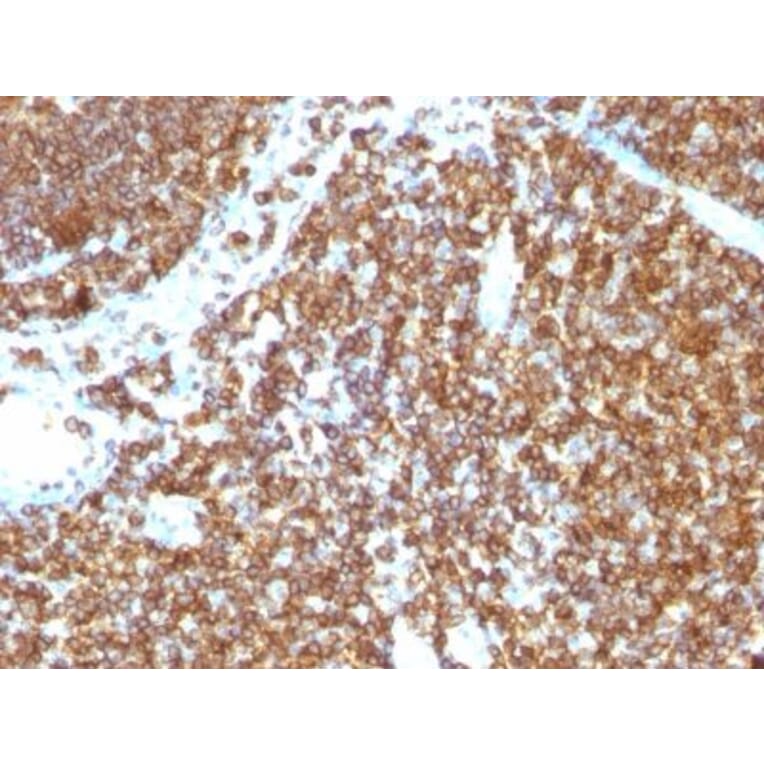 Immunohistochemistry (formalin-fixed, paraffin-embedded) - Anti-CD45RB Antibody [PTPRC/1147] (CF®640R) (A353143) - Antibodies.com