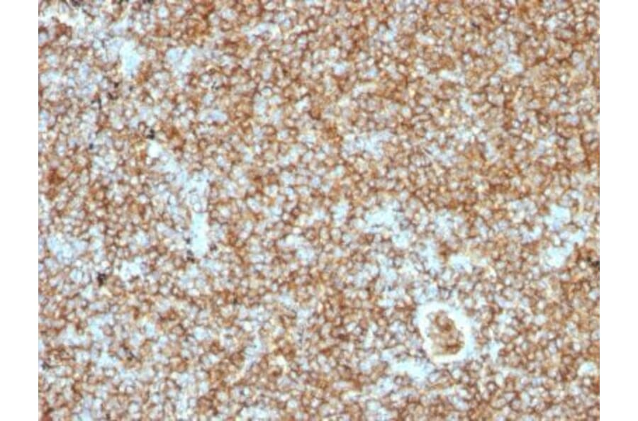 Immunohistochemistry (formalin-fixed, paraffin-embedded) - Anti-CD45RB Antibody [PTPRC/1147] (Biotin) (A353149) - Antibodies.com