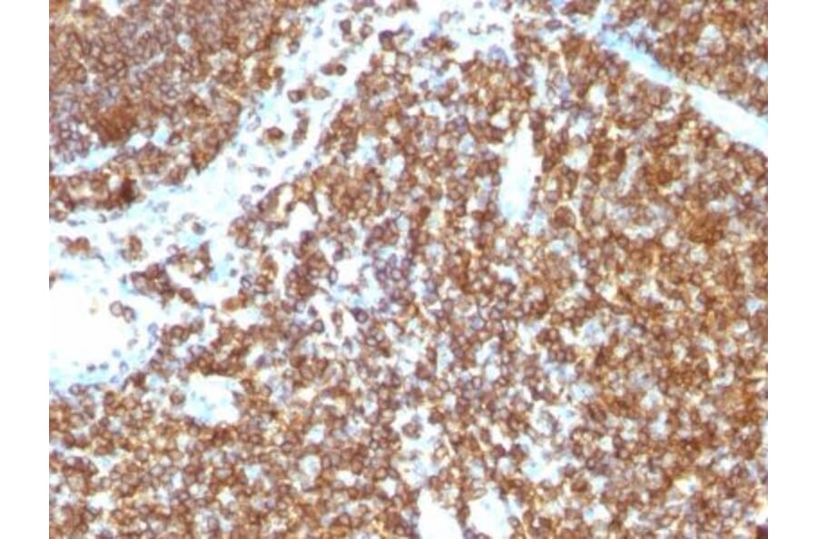 Immunohistochemistry (formalin-fixed, paraffin-embedded) - Anti-CD45RB Antibody [PTPRC/1147] (Biotin) (A353149) - Antibodies.com