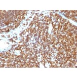 Immunohistochemistry (formalin-fixed, paraffin-embedded) - Anti-CD45RB Antibody [PTPRC/1147] (Biotin) (A353149) - Antibodies.com