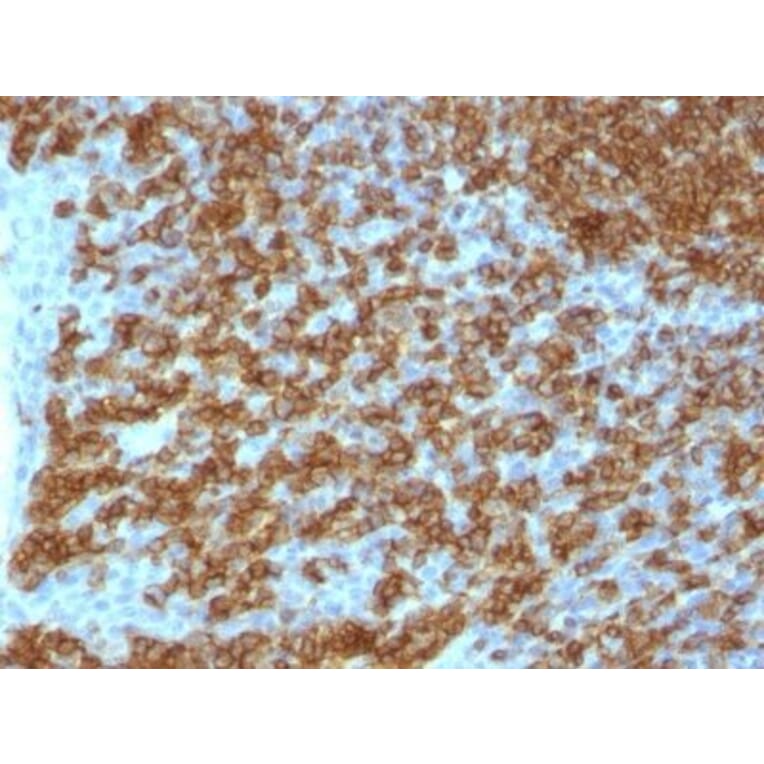 Immunohistochemistry (formalin-fixed, paraffin-embedded) - Anti-CD45RA Antibody [PTPRC/1148] (CF®640R) (A353151) - Antibodies.com