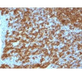 Immunohistochemistry (formalin-fixed, paraffin-embedded) - Anti-CD45RA Antibody [PTPRC/1148] (CF®568) (A353153) - Antibodies.com