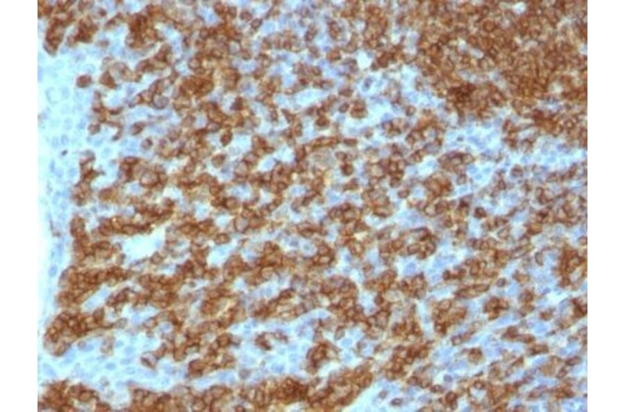Immunohistochemistry (formalin-fixed, paraffin-embedded) - Anti-CD45RA Antibody [PTPRC/1148] (Biotin) (A353157) - Antibodies.com