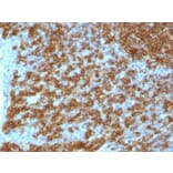 Immunohistochemistry (formalin-fixed, paraffin-embedded) - Anti-CD45RA Antibody [PTPRC/1148] (Biotin) (A353157) - Antibodies.com