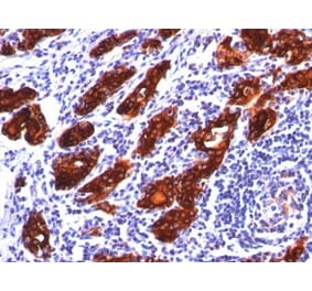 Immunohistochemistry (formalin-fixed, paraffin-embedded) - Anti-Transferrin Receptor Antibody [TFRC/1149] (CF®647) (A353160) - Antibodies.com
