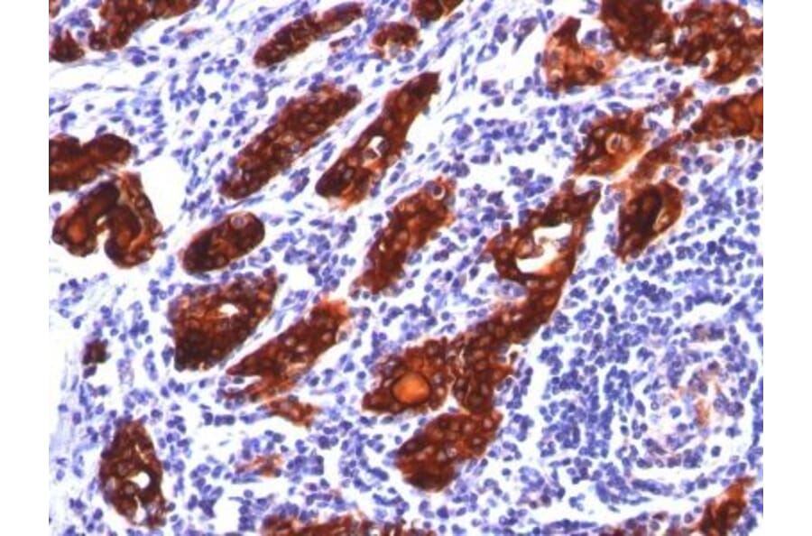 Immunohistochemistry (formalin-fixed, paraffin-embedded) - Anti-Transferrin Receptor Antibody [TFRC/1149] (CF®647) (A353160) - Antibodies.com