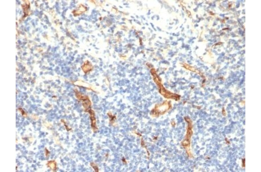Immunohistochemistry (formalin-fixed, paraffin-embedded) - Anti-CD34 Antibody [HPCA1/1171] (CF®405S) (A353166) - Antibodies.com