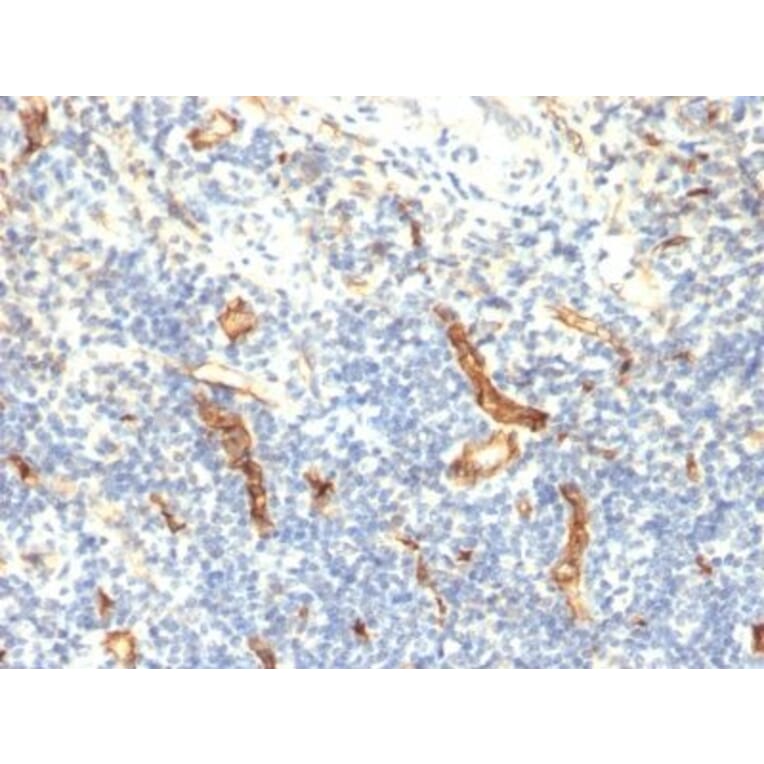 Immunohistochemistry (formalin-fixed, paraffin-embedded) - Anti-CD34 Antibody [HPCA1/1171] (CF®740) (A353170) - Antibodies.com