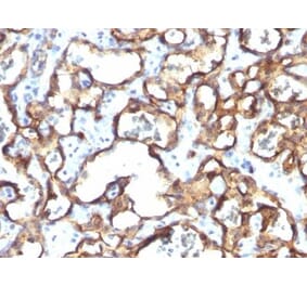 Immunohistochemistry (formalin-fixed, paraffin-embedded) - Anti-CD34 Antibody [HPCA1/1171] (CF®594) (A353172) - Antibodies.com