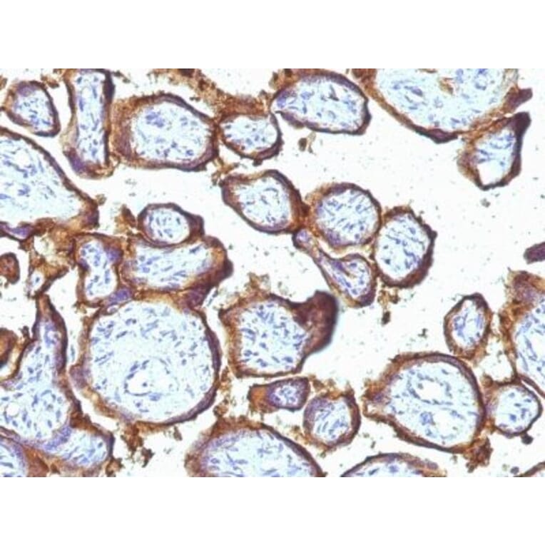 Immunohistochemistry (formalin-fixed, paraffin-embedded) - Anti-EGFR Antibody [31G7] (CF®405S) (A353174) - Antibodies.com