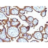 Immunohistochemistry (formalin-fixed, paraffin-embedded) - Anti-EGFR Antibody [31G7] (CF®640R) (A353175) - Antibodies.com