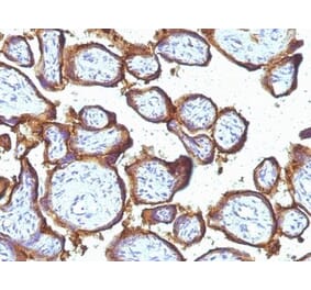 Immunohistochemistry (formalin-fixed, paraffin-embedded) - Anti-EGFR Antibody [31G7] (CF®740) (A353178) - Antibodies.com