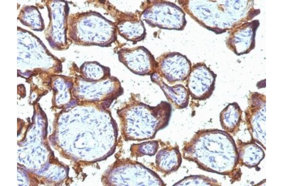 Immunohistochemistry (formalin-fixed, paraffin-embedded) - Anti-EGFR Antibody [31G7] (CF®488A) (A353179) - Antibodies.com