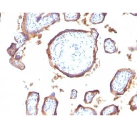Immunohistochemistry (formalin-fixed, paraffin-embedded) - Anti-EGFR Antibody [GFR1195] (CF®405S) (A353182) - Antibodies.com