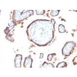 Immunohistochemistry (formalin-fixed, paraffin-embedded) - Anti-EGFR Antibody [GFR1195] (CF®640R) (A353183) - Antibodies.com